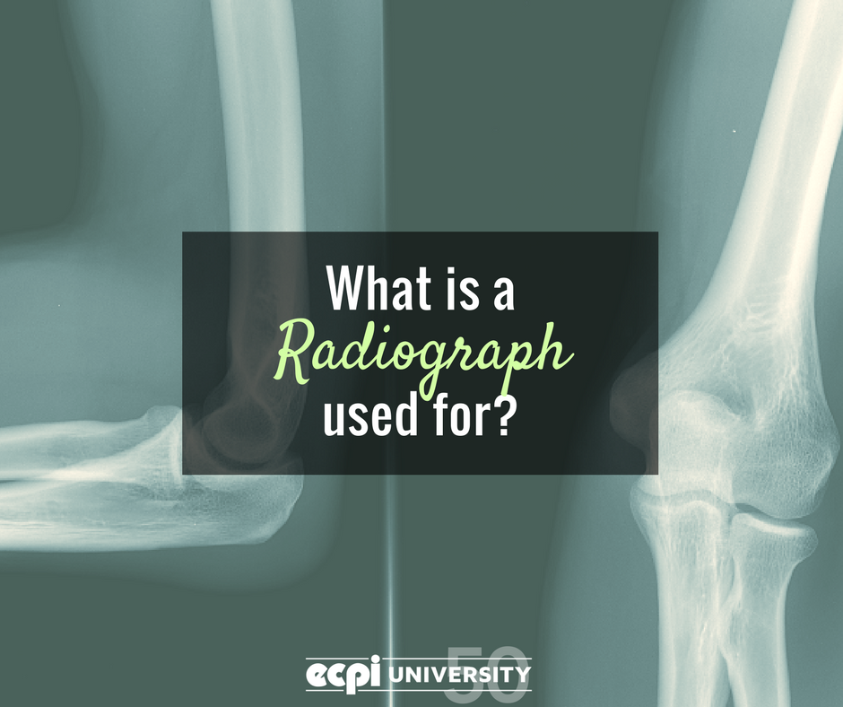 What is a Radiograph Used For?